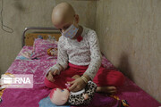 روزانه ۲۰۰ بیمار سرطانی در آذربایجان غربی خدمات رایگان دریافت می‌کنند